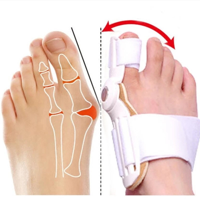Bunion Corrector™